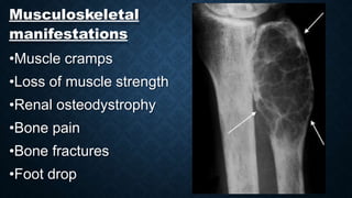 Musculoskeletal
manifestations
•Muscle cramps
•Loss of muscle strength
•Renal osteodystrophy
•Bone pain
•Bone fractures
•Foot drop
 