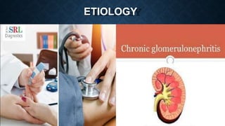 ETIOLOGY
 