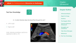 eBook for Undergraduate Education in Radiology
Chapter:
Ultrasound
Chapter Outline
6 – In which direction does the blood f...