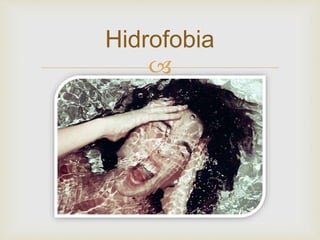 
Hidrofobia
 