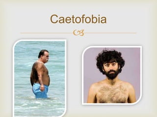 
Caetofobia
 
