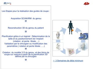 DiagnostiqLLLLLESueExamen radiologique :
Les Etapes pour la réalisation des guides de coupe :
Acquisition SCAN/IRM du genou

Envoi et traitement des images :
Reconstruction 3D du genou du patient

PPLPPropositiod’uneplanification et validation du chi
Planification grâce à un logiciel : Détermination de la
taille et du positionnement de l’implant
(rotation et pente tibiale …)
Validation par le chirurgien ou modification des
paramètres ( rotation et pente tibiale …..)

Fabrication et livraison du guide :
Création du modèle 3 D du genou et des blocs de
coupe sur mesure à partir de la planification 3D
définie par le chirurgien

Chirurgie
 3 Semaines de délai minimum
 