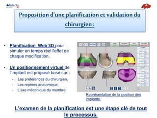 MyKnee workflow
L'examen de la planification est une étape clé de tout
le processus.
Proposition d’une planificationet validationdu
chirurgien:
• Planification Web 3D pour
simuler en temps réel l'effet de
chaque modification.
• Un positionnement virtuel de
l’implant est proposé basé sur :
- Les préférences du chirurgien,
- Les repères anatomique,
- L’axe mécanique du membre,
Représentation de la position des
implants.
 