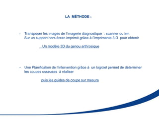 LA MÉTHODE :
- Transposer les images de l’imagerie diagnostique : scanner ou irm
Sur un support hors écran imprimé grâce à l’imprimante 3 D pour obtenir
Un modèle 3D du genou arthrosique
- Une Planification de l’intervention grâce à un logiciel permet de déterminer
les coupes osseuses à réaliser
puis les guides de coupe sur mesure
 