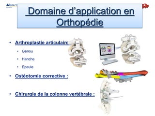 • Arthroplastie articulaire :
• Genou
• Hanche
• Epaule
• Ostéotomie corrective :
• Chirurgie de la colonne vertébrale :
Domaine d’application en
Orthopédie
 