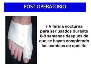 HV férula nocturna
para ser usados ​durante
6-8 semanas después de
que se hayan completado
los cambios de apósito

 