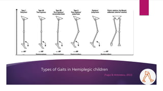 Management of Gait in Hemiplegic CP | PPTX