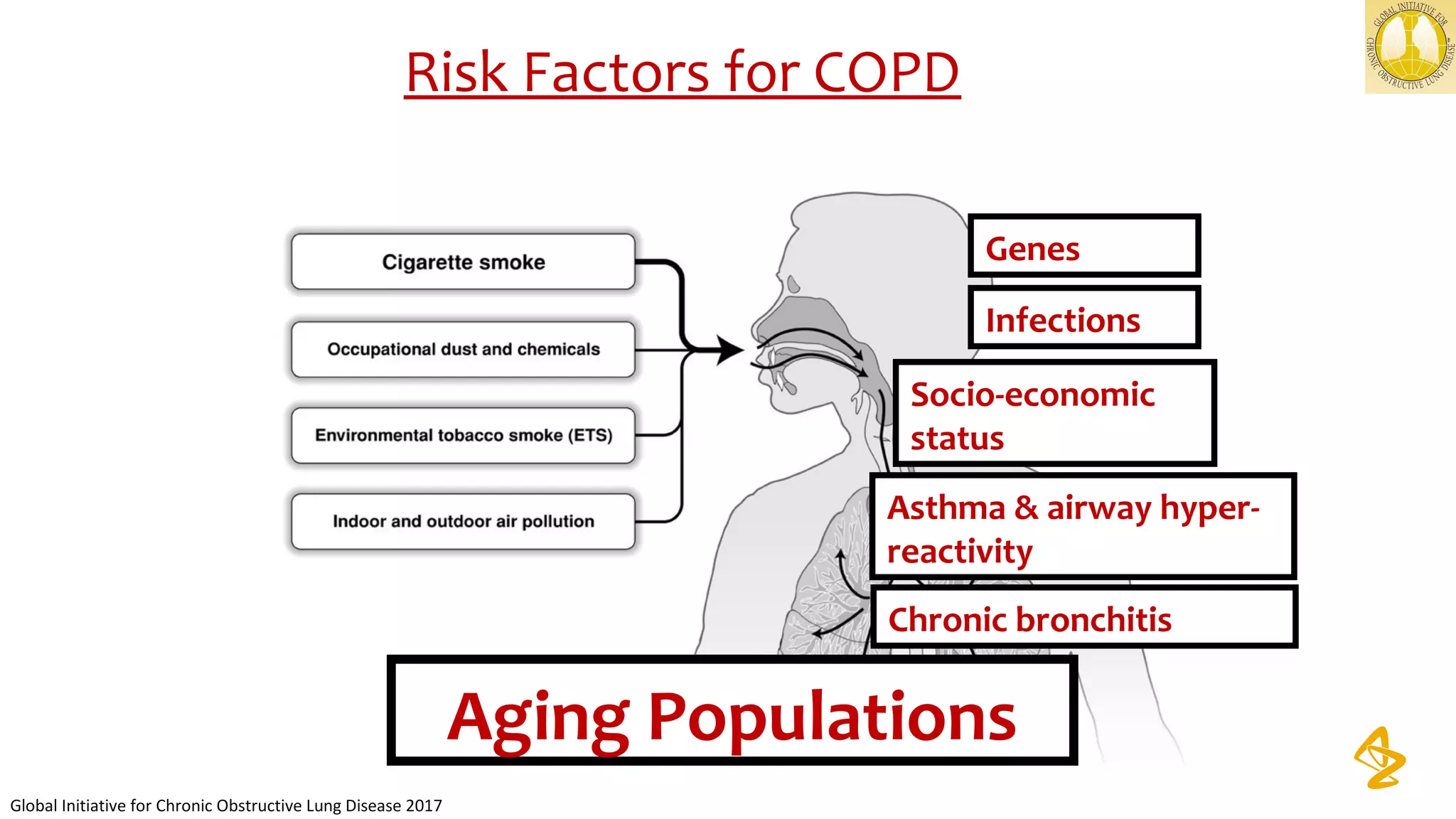 Risk Factors for COPD
Genes
Infections
Socio-economic
status
Aging Populations
Global Initiative for Chronic Obstructive Lung Disease 2017
Asthma & airway hyper-
reactivity
Chronic bronchitis
 