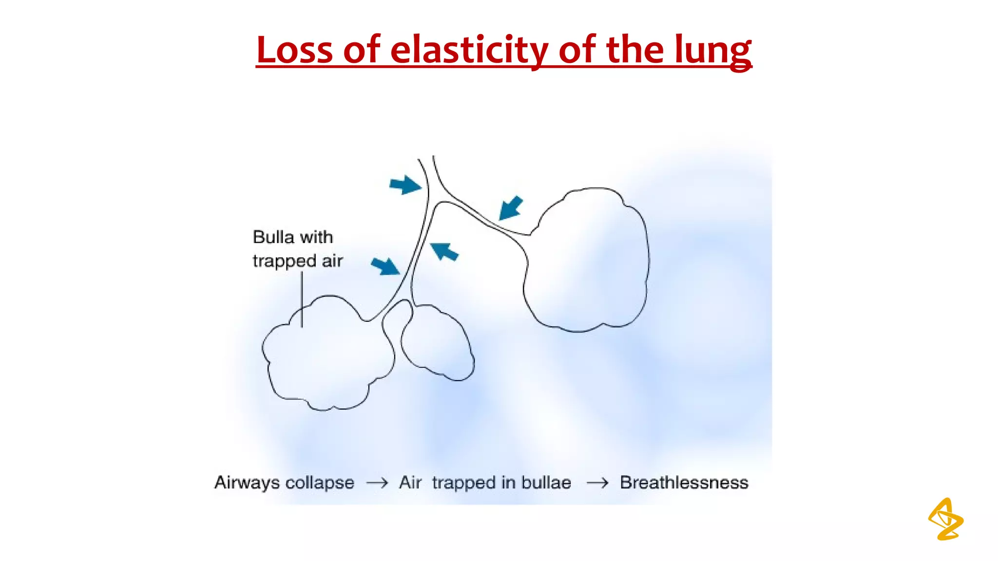 Loss of elasticity of the lung
 