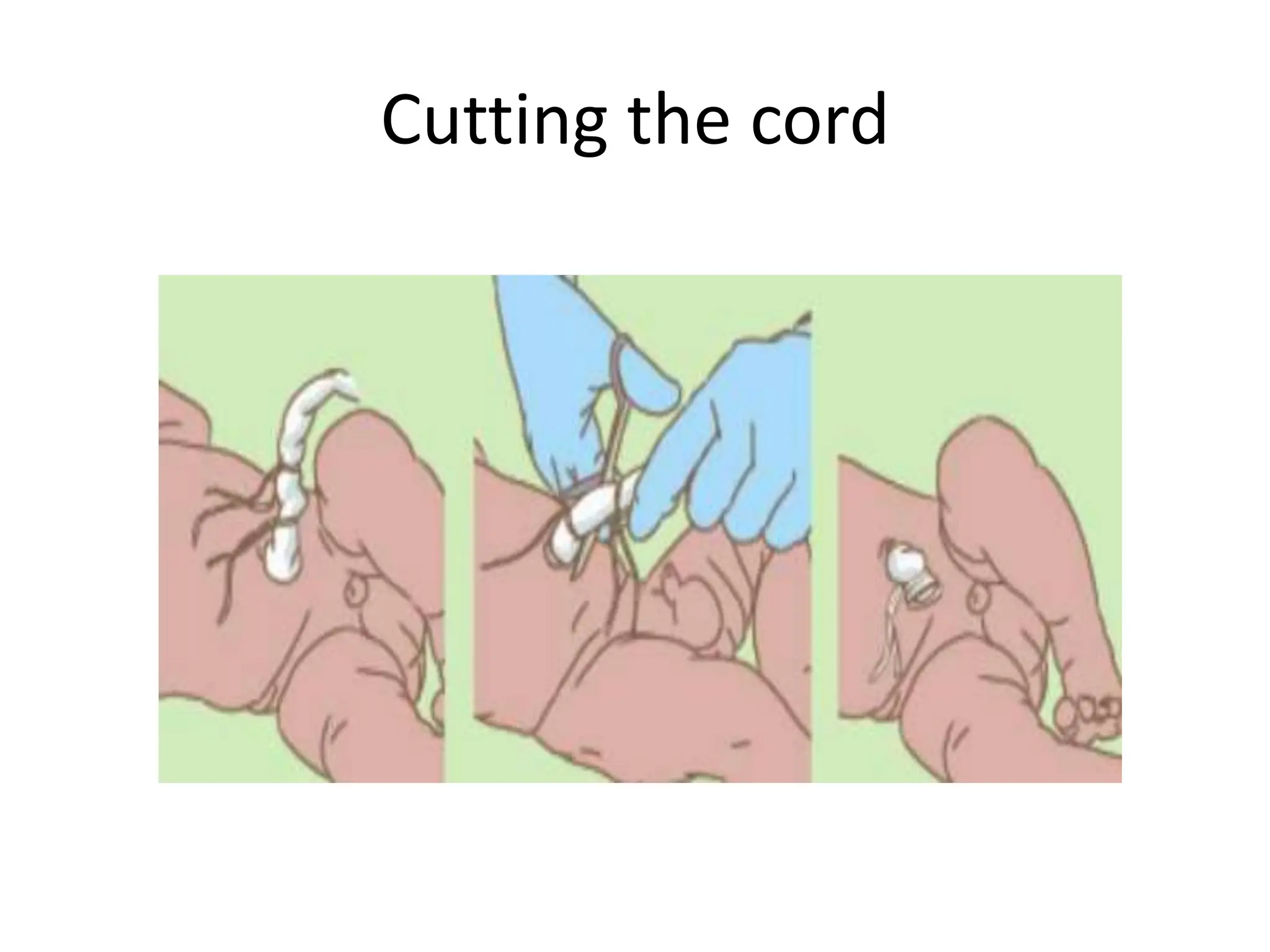 Cutting the cord
 