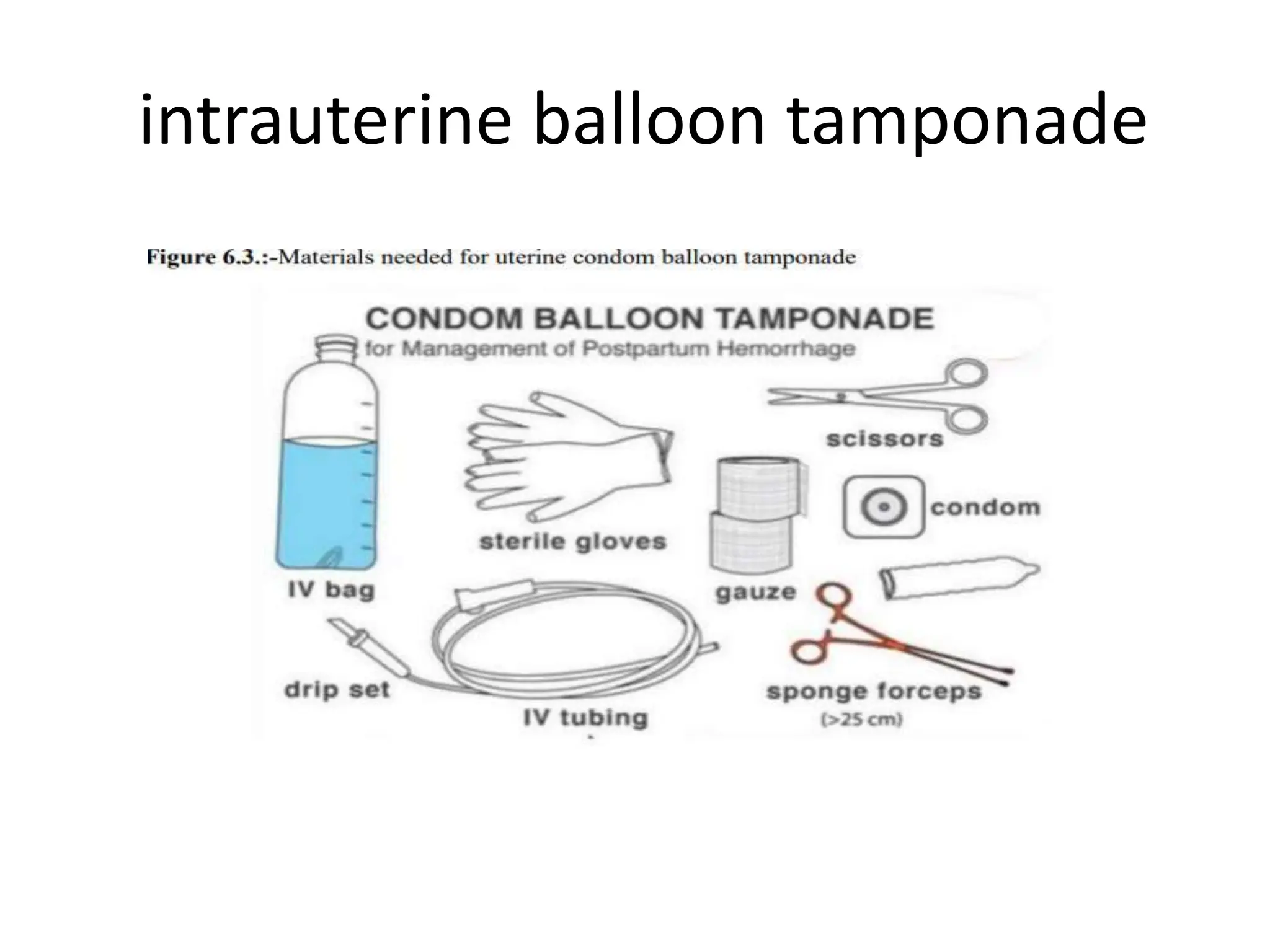 intrauterine balloon tamponade
 
