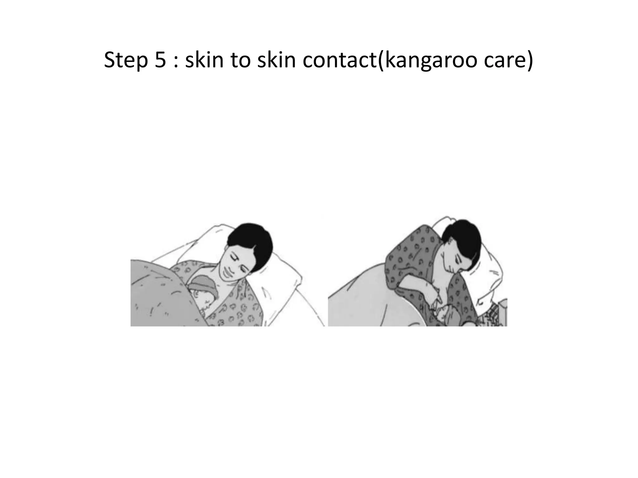 Step 5 : skin to skin contact(kangaroo care)
 