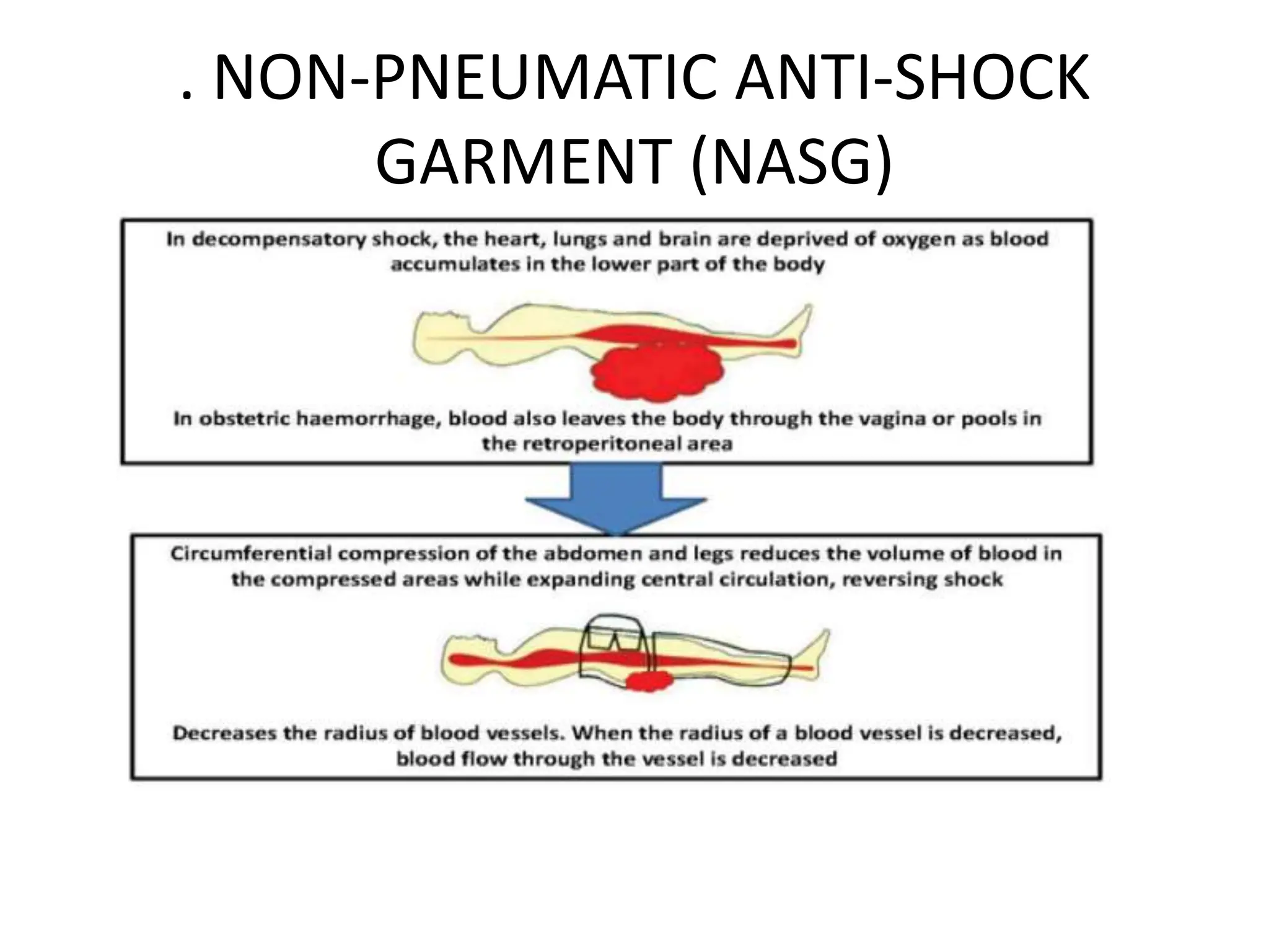 . NON-PNEUMATIC ANTI-SHOCK
GARMENT (NASG)
 