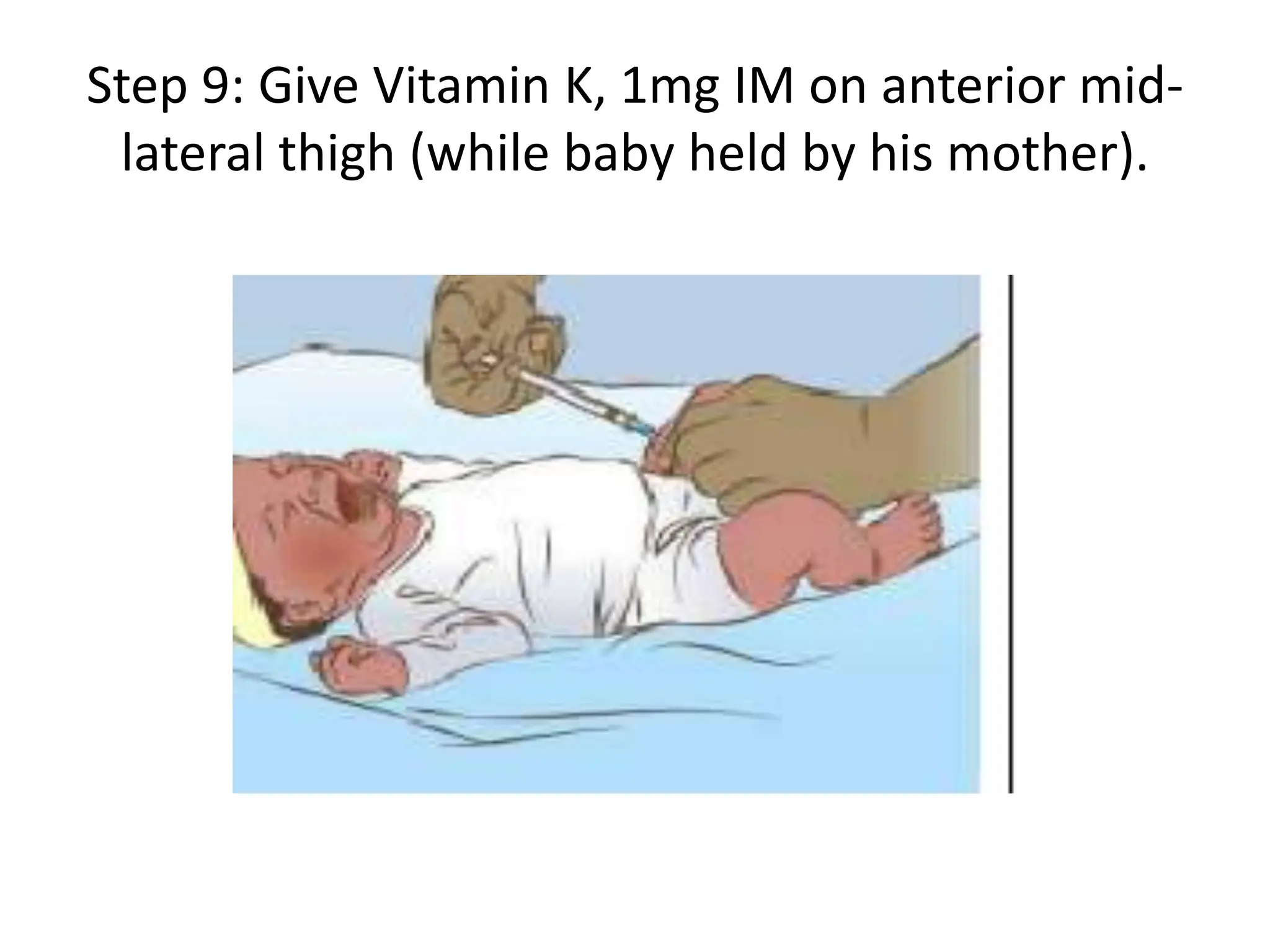 Step 9: Give Vitamin K, 1mg IM on anterior mid-
lateral thigh (while baby held by his mother).
 
