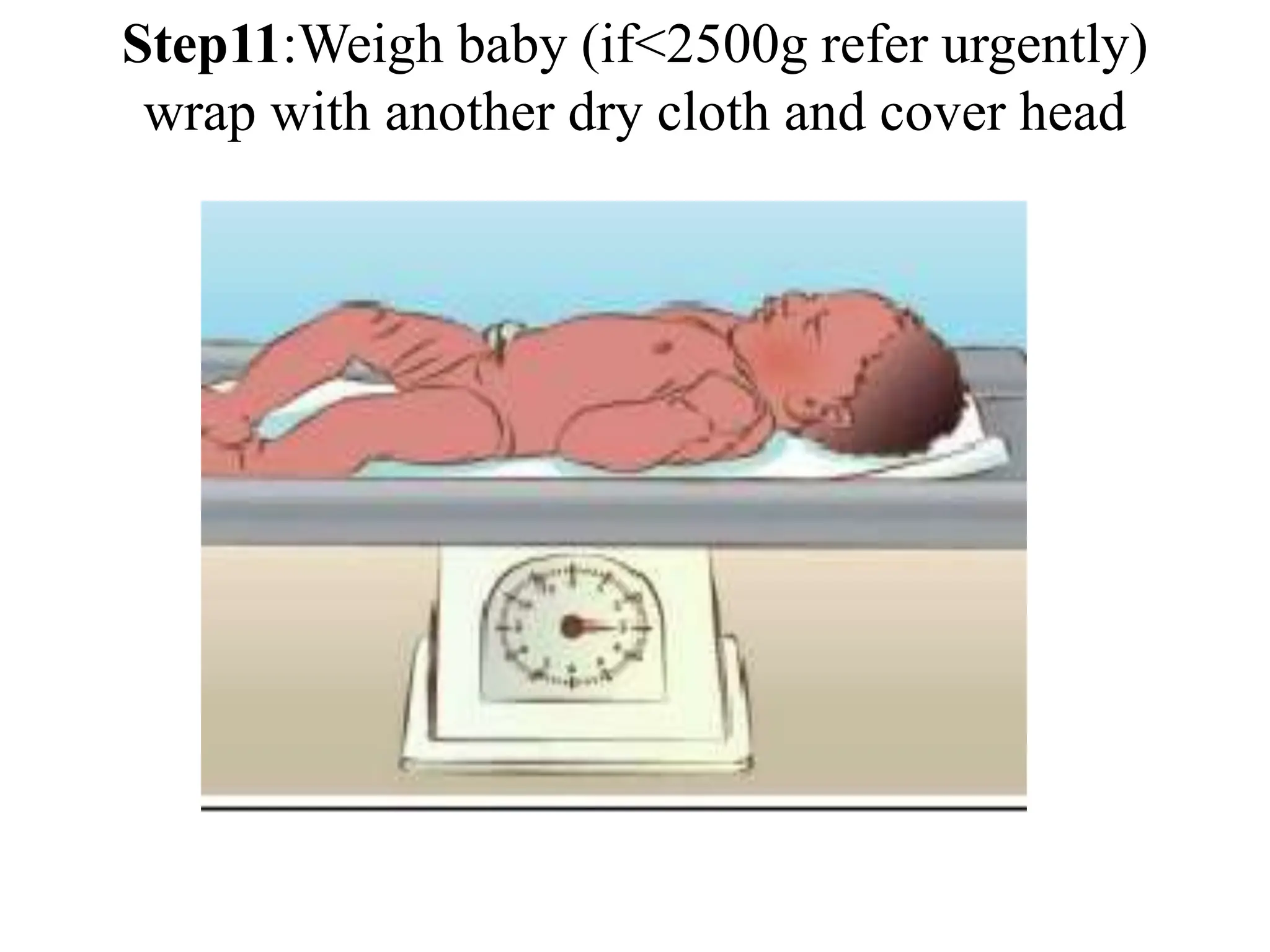 Step11:Weigh baby (if<2500g refer urgently)
wrap with another dry cloth and cover head
 