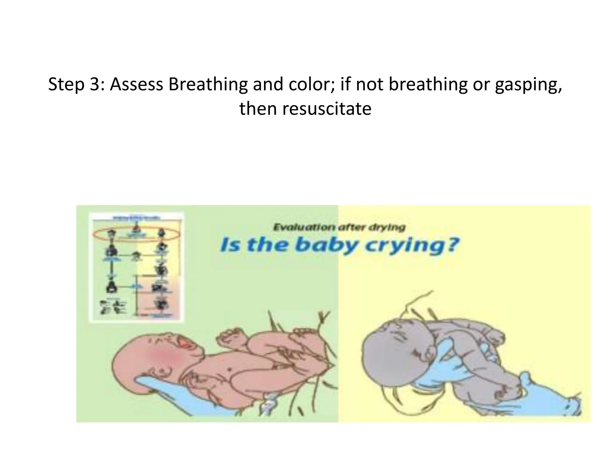 Step 3: Assess Breathing and color; if not breathing or gasping,
then resuscitate
 