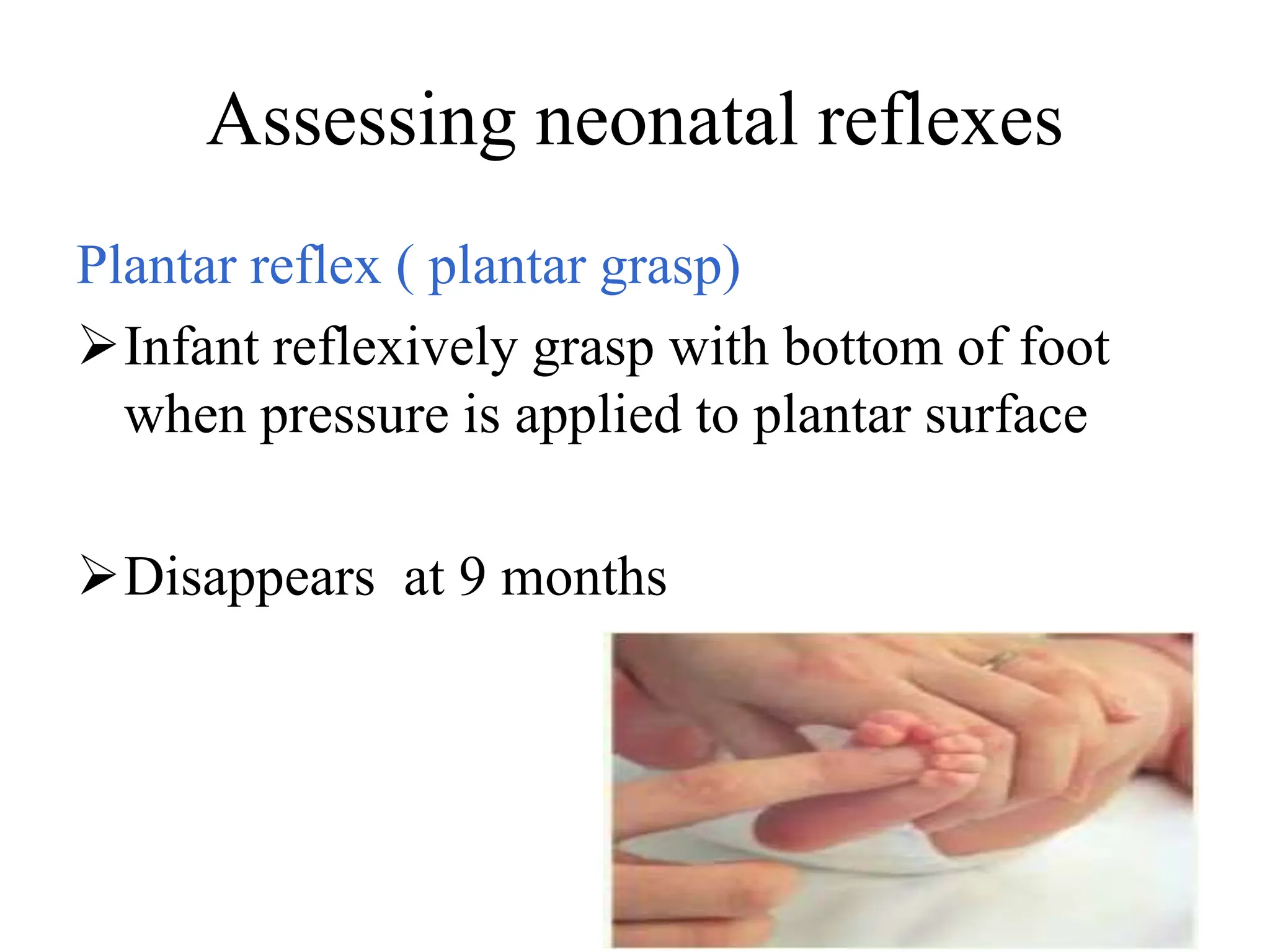 Assessing neonatal reflexes
Plantar reflex ( plantar grasp)
Infant reflexively grasp with bottom of foot
when pressure is applied to plantar surface
Disappears at 9 months
 