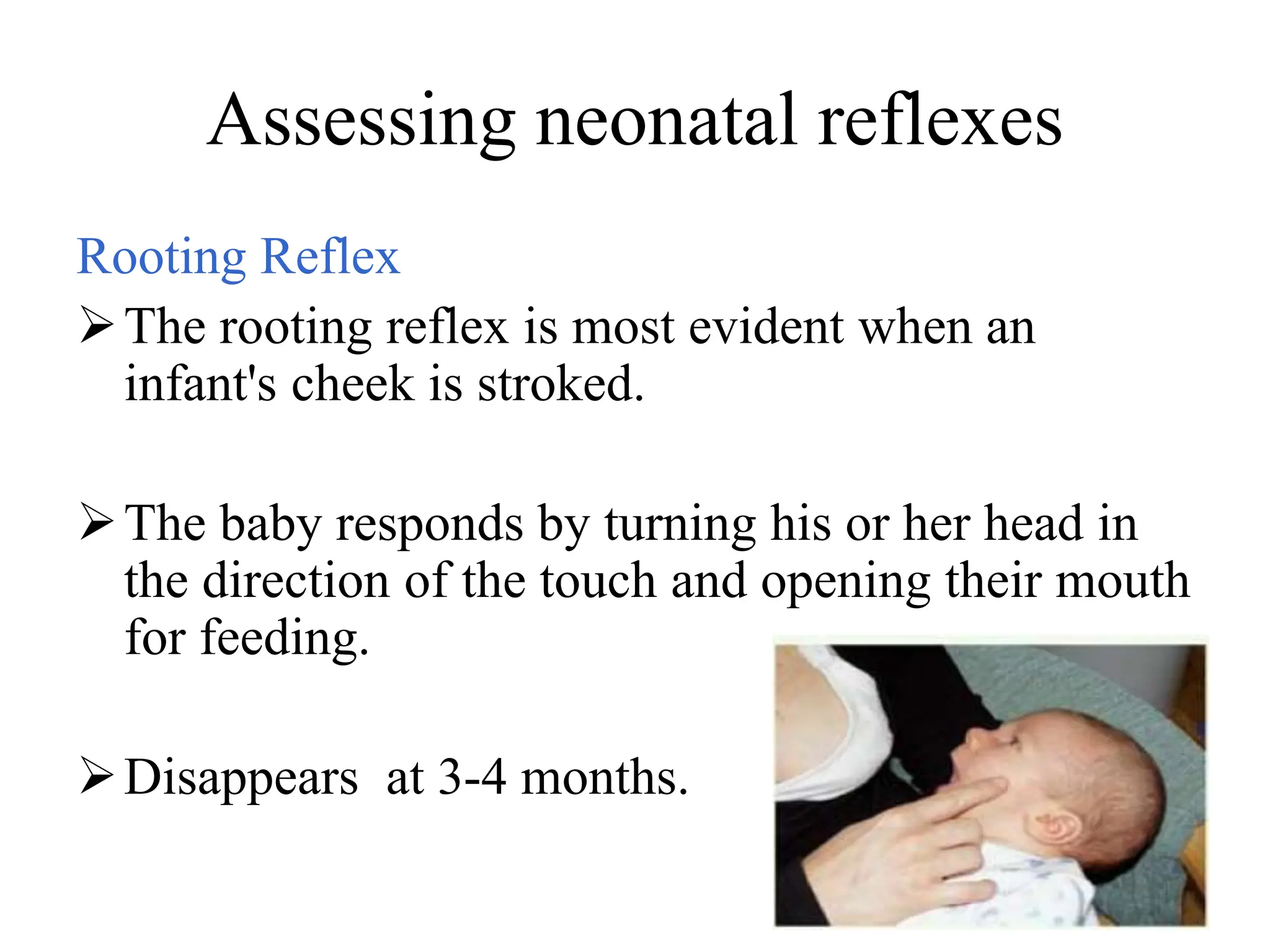 Assessing neonatal reflexes
Rooting Reflex
The rooting reflex is most evident when an
infant's cheek is stroked.
The baby responds by turning his or her head in
the direction of the touch and opening their mouth
for feeding.
Disappears at 3-4 months.
 