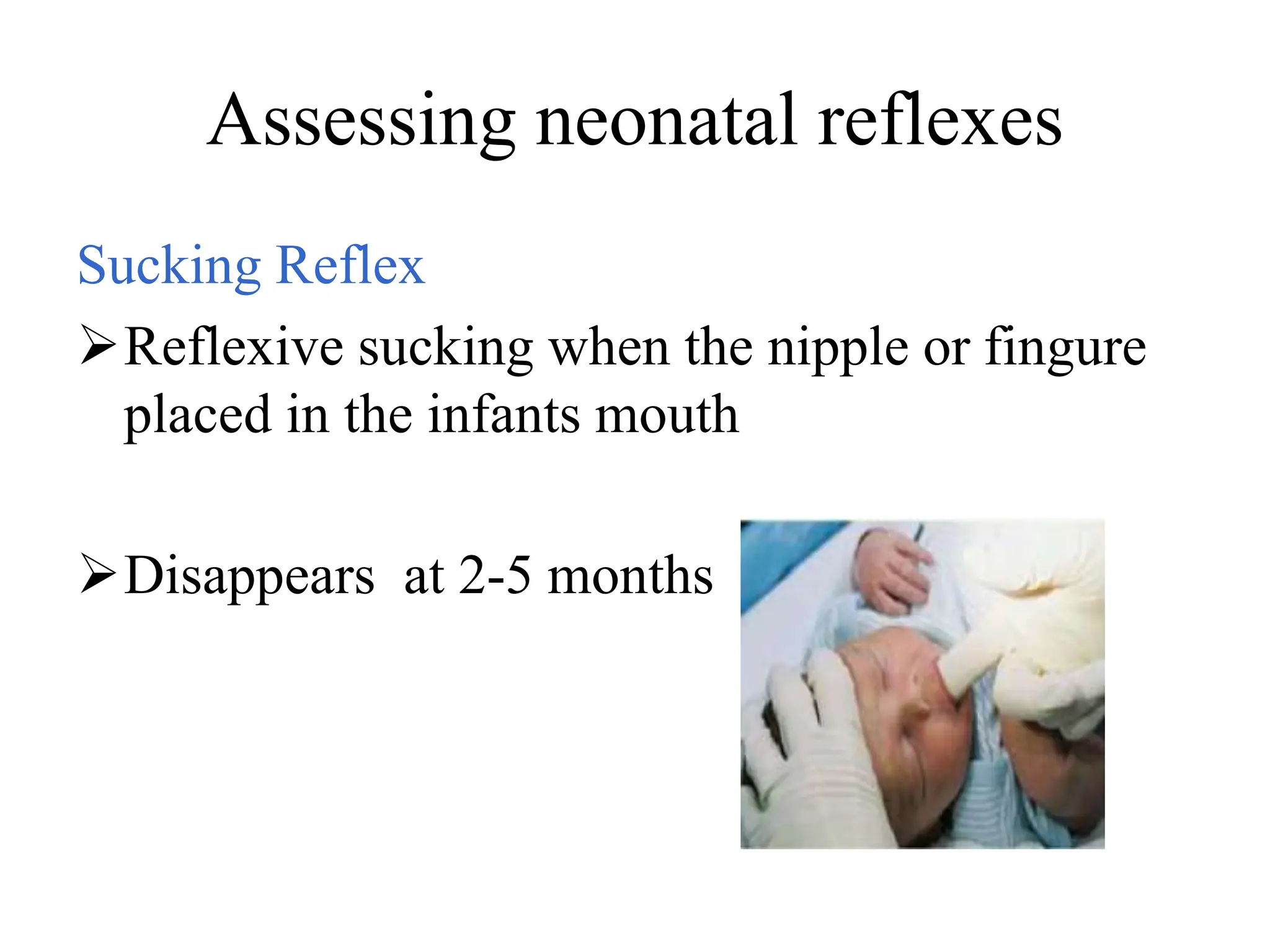 Assessing neonatal reflexes
Sucking Reflex
Reflexive sucking when the nipple or fingure
placed in the infants mouth
Disappears at 2-5 months
 
