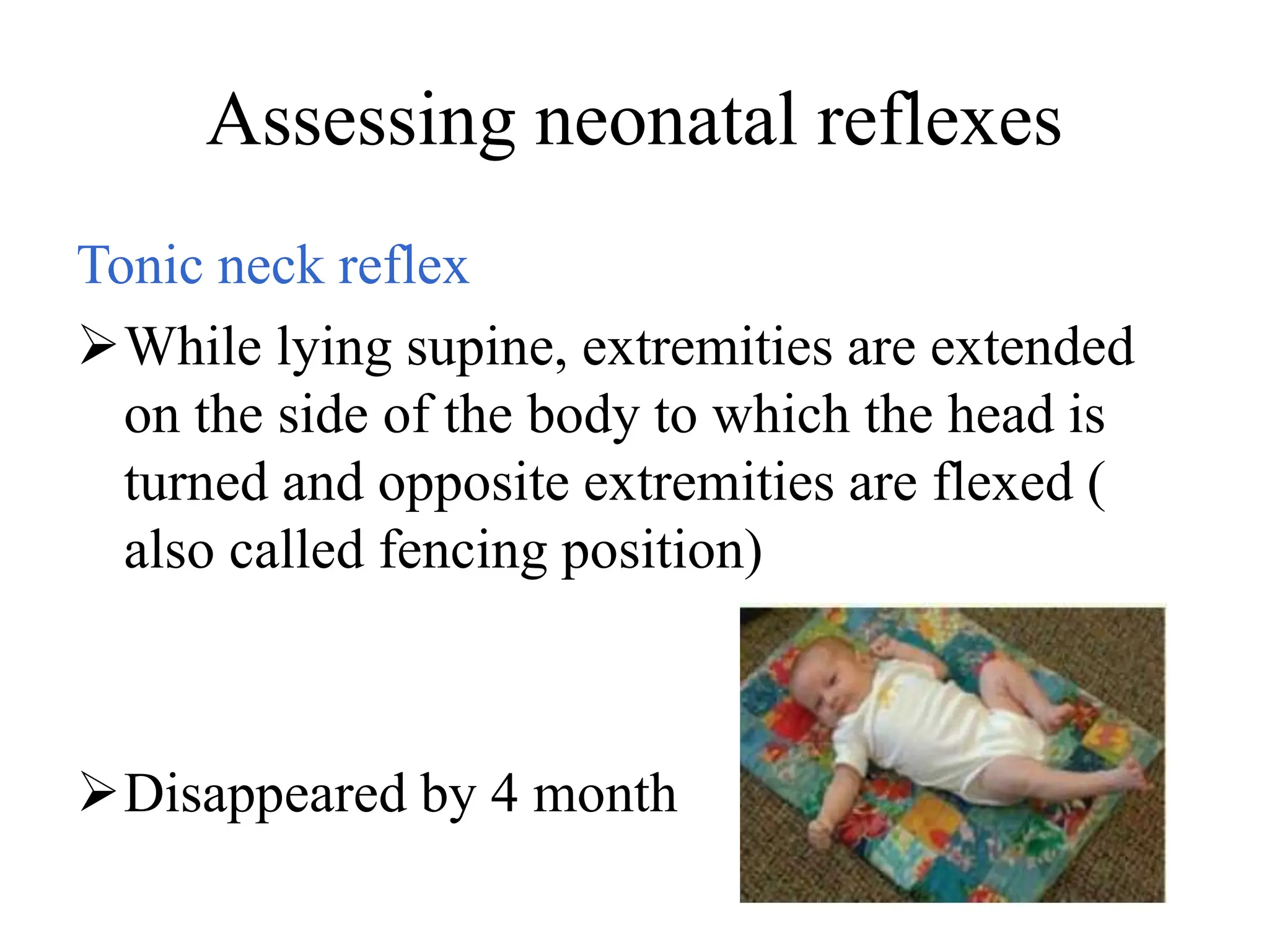 Assessing neonatal reflexes
Tonic neck reflex
While lying supine, extremities are extended
on the side of the body to which the head is
turned and opposite extremities are flexed (
also called fencing position)
Disappeared by 4 month
 