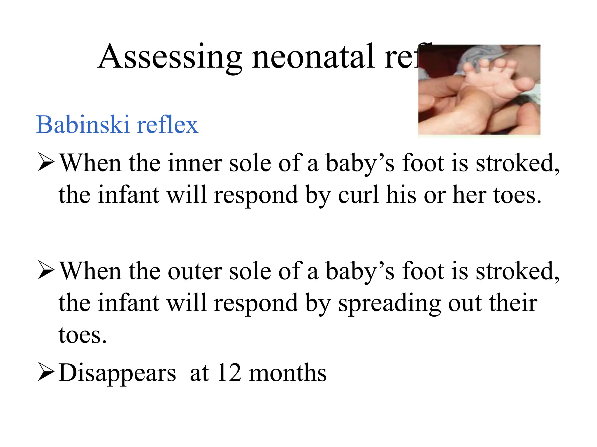Assessing neonatal reflexes
Babinski reflex
When the inner sole of a baby’s foot is stroked,
the infant will respond by curl his or her toes.
When the outer sole of a baby’s foot is stroked,
the infant will respond by spreading out their
toes.
Disappears at 12 months
 
