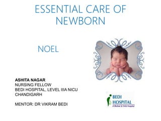ESSENTIAL CARE OF
NEWBORN
NOEL
ASHITA NAGAR
NURSING FELLOW
BEDI HOSPITAL, LEVEL IIIA NICU
CHANDIGARH
MENTOR: DR VIKRAM BEDI
 