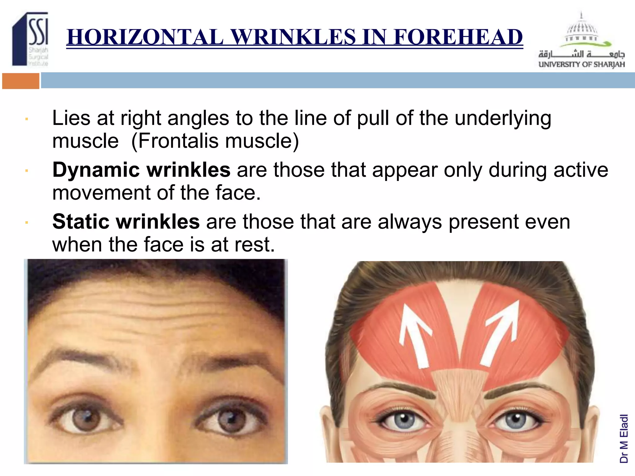 Essential anatomy for facial injections | PPTX