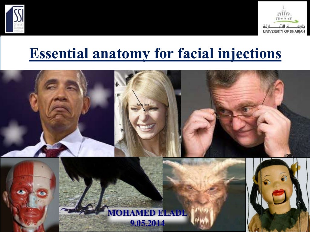 Essential anatomy for facial injections