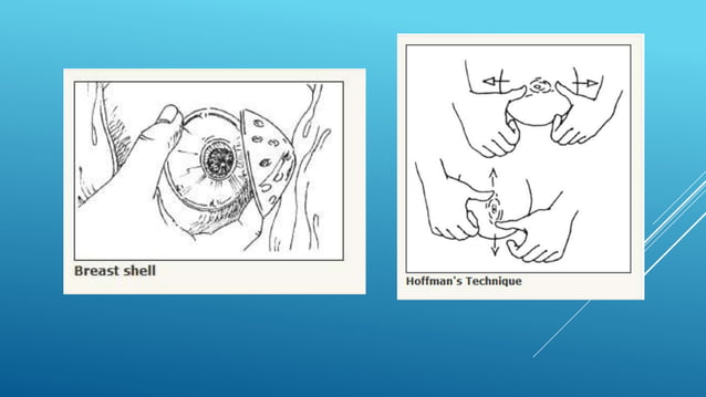 Essential Intrapartum and Newborn Care (EINC).pptx | Pregnancy ...