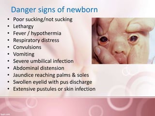 Danger signs of newborn
• Poor sucking/not sucking
• Lethargy
• Fever / hypothermia
• Respiratory distress
• Convulsions
• Vomiting
• Severe umbilical infection
• Abdominal distension
• Jaundice reaching palms & soles
• Swollen eyelid with pus discharge
• Extensive pustules or skin infection
 