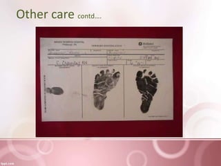 Other care contd….
 
