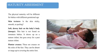 MATURITY ASSESSMENT
The physical maturity will be different
for babies with different gestational age
Skin textures: Is the skin sticky,
smooth, or peeling?
Soft, downy hair on the baby’s body
(lanugo): This hair is not found on
immature babies. It shows up on a
mature infant, but goes away for a post
mature infant.
Plantar creases: These are creases on
the soles of the feet. They can be absent
or range up to covering the entire foot.
 