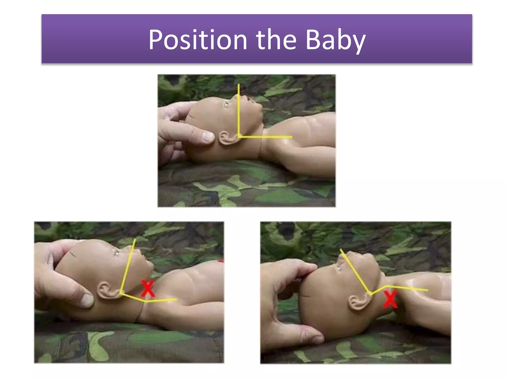 Newborn Positioning Essential Newborn Care | PPTX