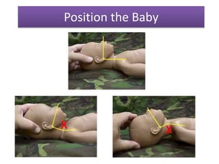 Essential Newborn Care | PPTX