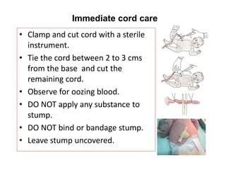 Immediate cord care
• Clamp and cut cord with a sterile
instrument.
• Tie the cord between 2 to 3 cms
from the base and cut the
remaining cord.
• Observe for oozing blood.
• DO NOT apply any substance to
stump.
• DO NOT bind or bandage stump.
• Leave stump uncovered.
 