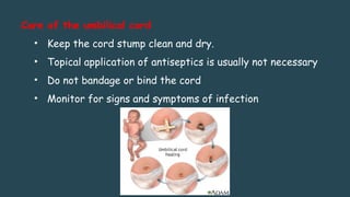 Care of the umbilical cord
• Keep the cord stump clean and dry.
• Topical application of antiseptics is usually not necessary
• Do not bandage or bind the cord
• Monitor for signs and symptoms of infection
 