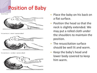 Infant Neck Rotation Essential new born care converted | PDF