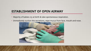ESTABLISHMENT OF OPEN AIRWAY
• Majority of babies cry at birth & take spontaneous respiration.
• Immediately suction the secretions, wipe mucus from face, mouth and nose.
 