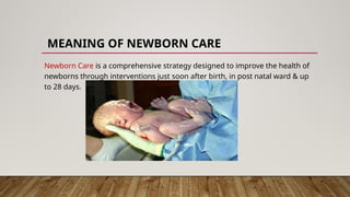 MEANING OF NEWBORN CARE
Newborn Care is a comprehensive strategy designed to improve the health of
newborns through interventions just soon after birth, in post natal ward & up
to 28 days.
 