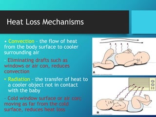 Heat Loss Mechanisms
• Convection – the flow of heat
from the body surface to cooler
surrounding air
– Eliminating drafts such as
windows or air con, reduces
convection
• Radiation – the transfer of heat to
a cooler object not in contact
with the baby
– Cold window surface or air con;
moving as far from the cold
surface, reduces heat loss
 