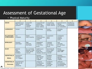 Assessment of Gestational Age
• Physical Maturity
 