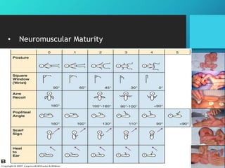 • Neuromuscular Maturity
 