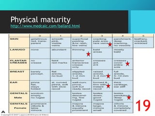 Physical maturity
http://www.medcalc.com/ballard.html
19
 