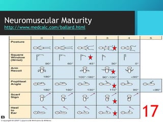 Neuromuscular Maturity
http://www.medcalc.com/ballard.html
17
 