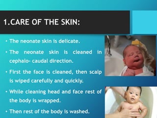 1.CARE OF THE SKIN:
• The neonate skin is delicate.
• The neonate skin is cleaned in
cephalo- caudal direction.
• First the face is cleaned, then scalp
is wiped carefully and quickly.
• While cleaning head and face rest of
the body is wrapped.
• Then rest of the body is washed.
 
