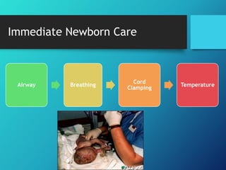 Immediate Newborn Care
Airway Breathing
Cord
Clamping
Temperature
 