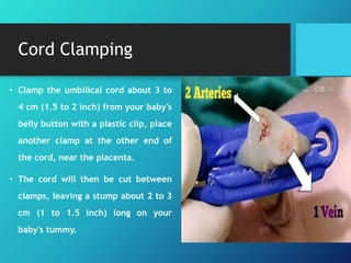 Cord Clamping
• Clamp the umbilical cord about 3 to
4 cm (1.5 to 2 inch) from your baby's
belly button with a plastic clip, place
another clamp at the other end of
the cord, near the placenta.
• The cord will then be cut between
clamps, leaving a stump about 2 to 3
cm (1 to 1.5 inch) long on your
baby's tummy.
 