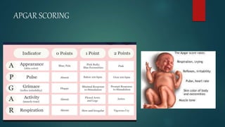ESSENTIAL NEW BORN CARE | PPTX
