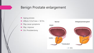 Benign Prostate enlargement
 Aging process
 Affects 1/3 of men > 50 Yrs
 May cause symptoms
 May improve
 Occ Prostatectomy
 