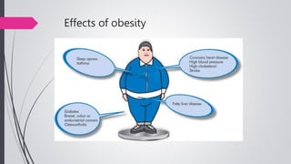 Effects of obesity
 